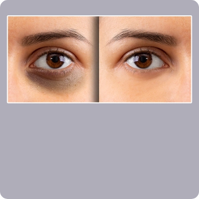 Complexion Adjustments