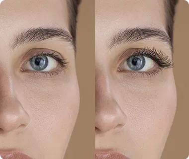 Eye enhancement