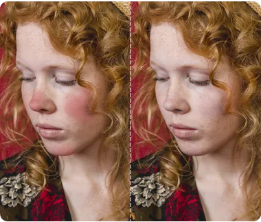 Redness removal