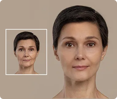 Scar and wrinkle retouching