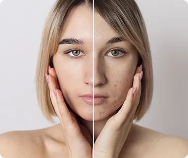 Skin smoothing