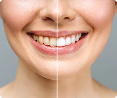 Teeth whitening and hair corrections
